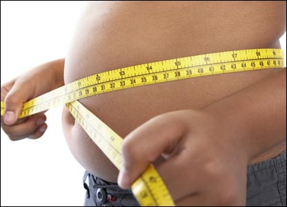 Vitamin D Deficiency Associated With Different Types of Obesity In Black Kids