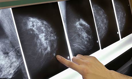 Concern Growing Over False Positve <br /> Mammography Rates In Minorities