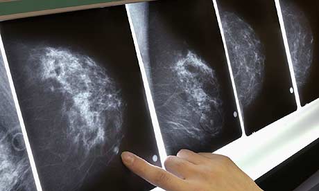 Half Of All Women Ignore <br />Mammogram Recommendations